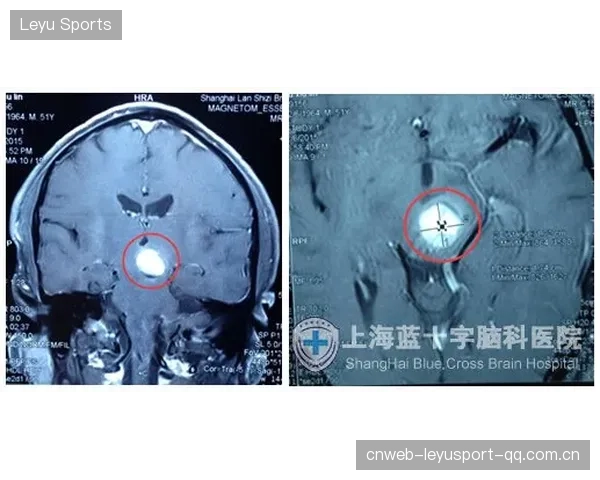 惠特摩尔战胜血栓：从“血管梦想”到“生命守护”的转变